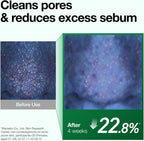 1+1 Value Sets - Anua Heartleaf Pore Control Cleansing Oil 200ml