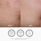 1+1 Value Sets - Dr. Althea Vitamin C Boosting Serum 30ml