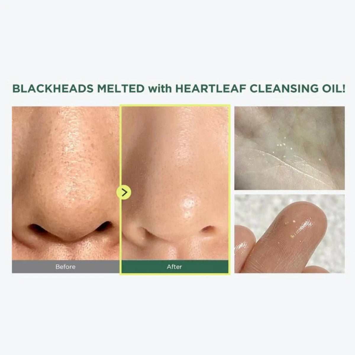 Anua Heartleaf Pore Control Cleansing Oil Mild 200ml (Clearance)