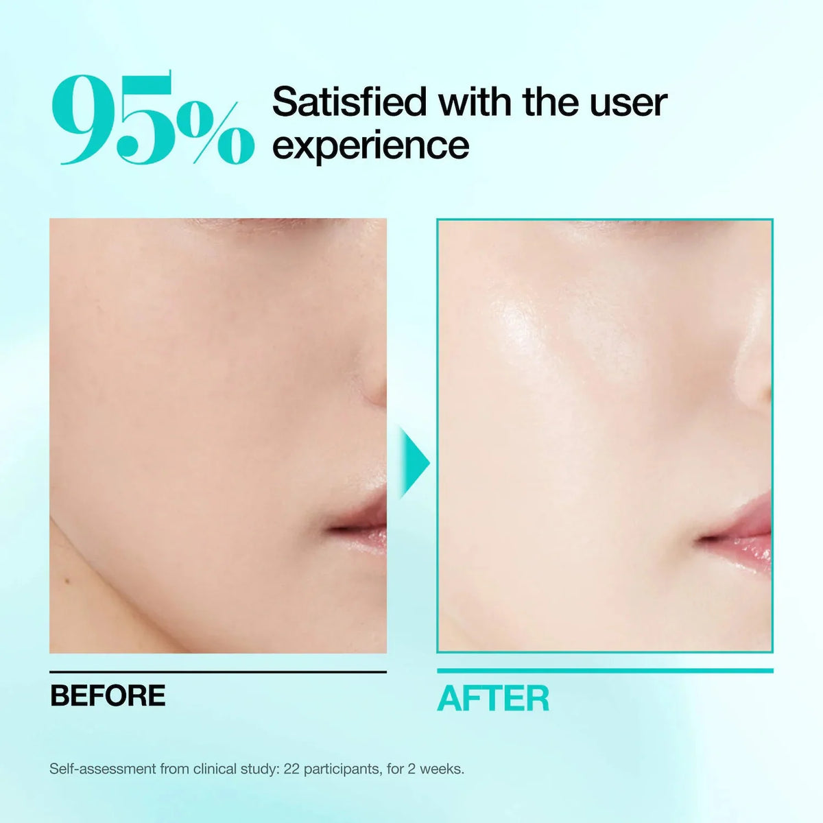 ANUA PDRN Hyaluron 100 Serum Mask 1pc