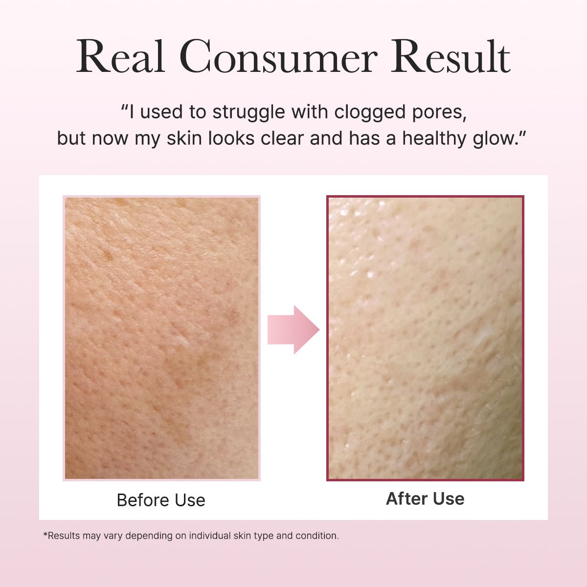 Arencia Royal Rosehip Rice Mochi Cleanser 120g