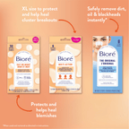 Bioré Day or Night Blemish Patches Value Pack 54pcs