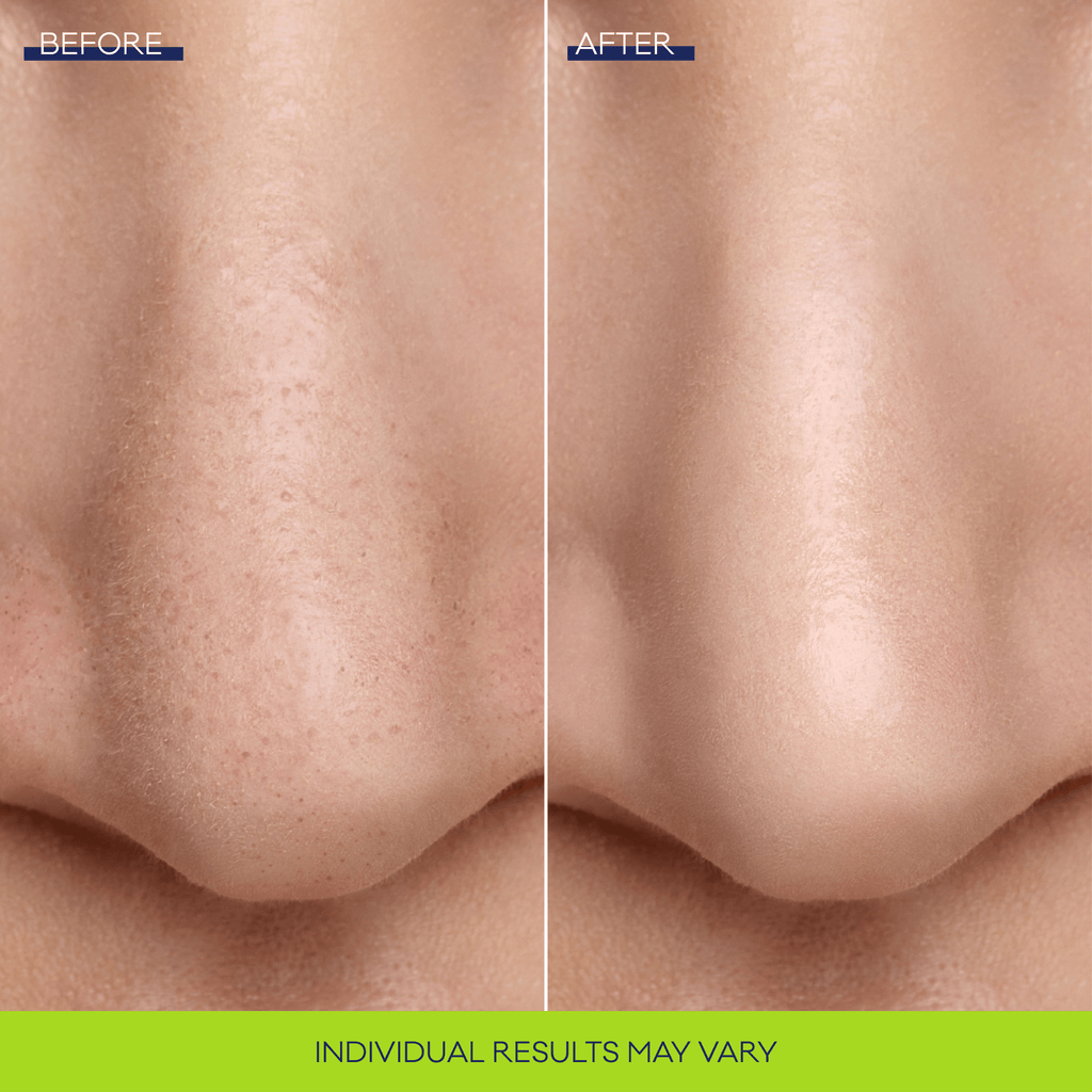 Bioré Pore Refining Bubbling Nose Mask 8pcs