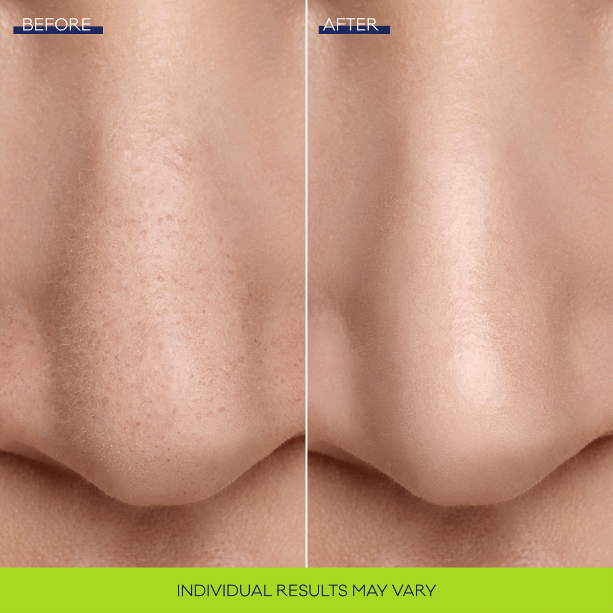 Bioré Pore Refining Bubbling Nose Mask 8pcs