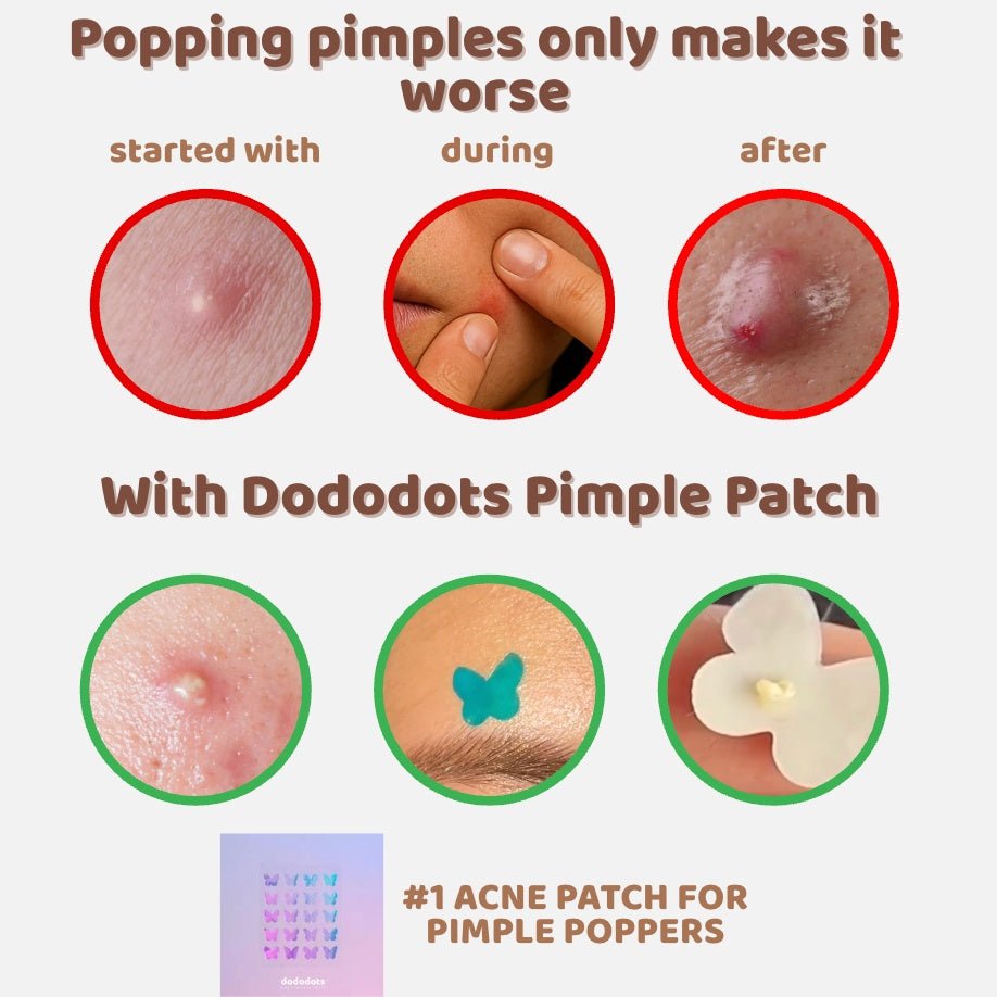 Dododots Nice Buns, Huns 20 pcs