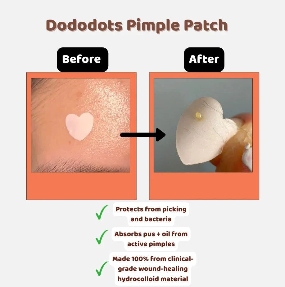 Dododots Nice Buns, Huns 20 pcs