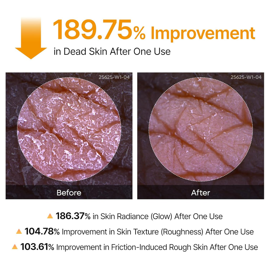 Dr. Melaxin Peel Shot Exfoliating Kojic Acid Turmeric Spray 200ml