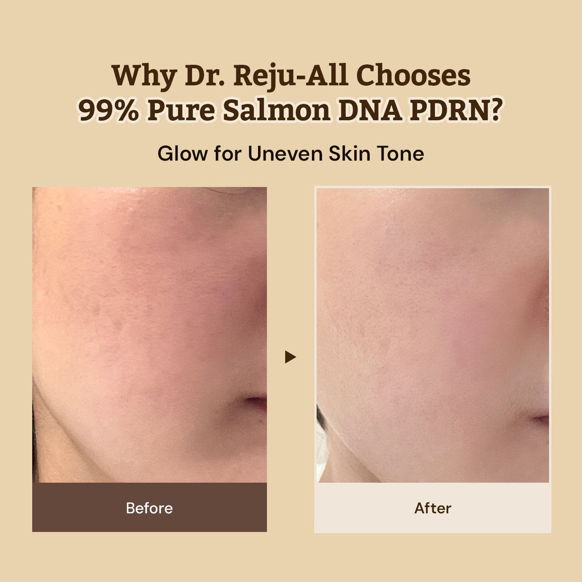 Dr.Reju-All Advanced PDRN Rejuvenating Cream Max 60ml