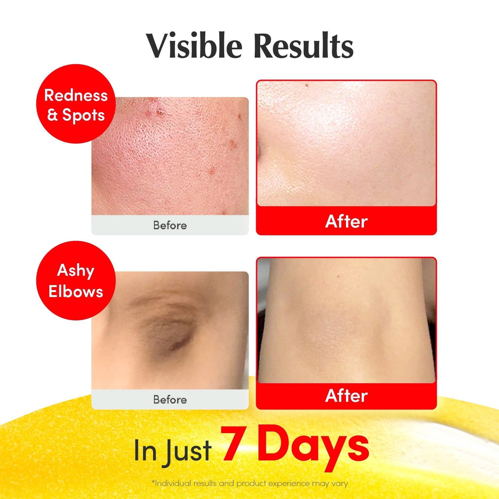 EQQUALBERRY Vitamin illuminating Serum 30ml