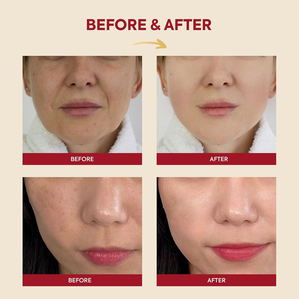 KSECRET SEOUL 1988 Essence: Snail Mucin 97% + Rice 100ml