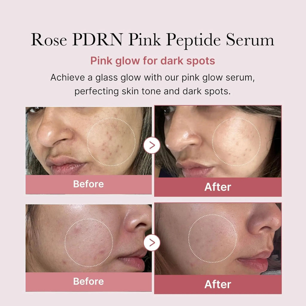 medicube PDRN Plump & Glow Duo - Hydration & Radiance