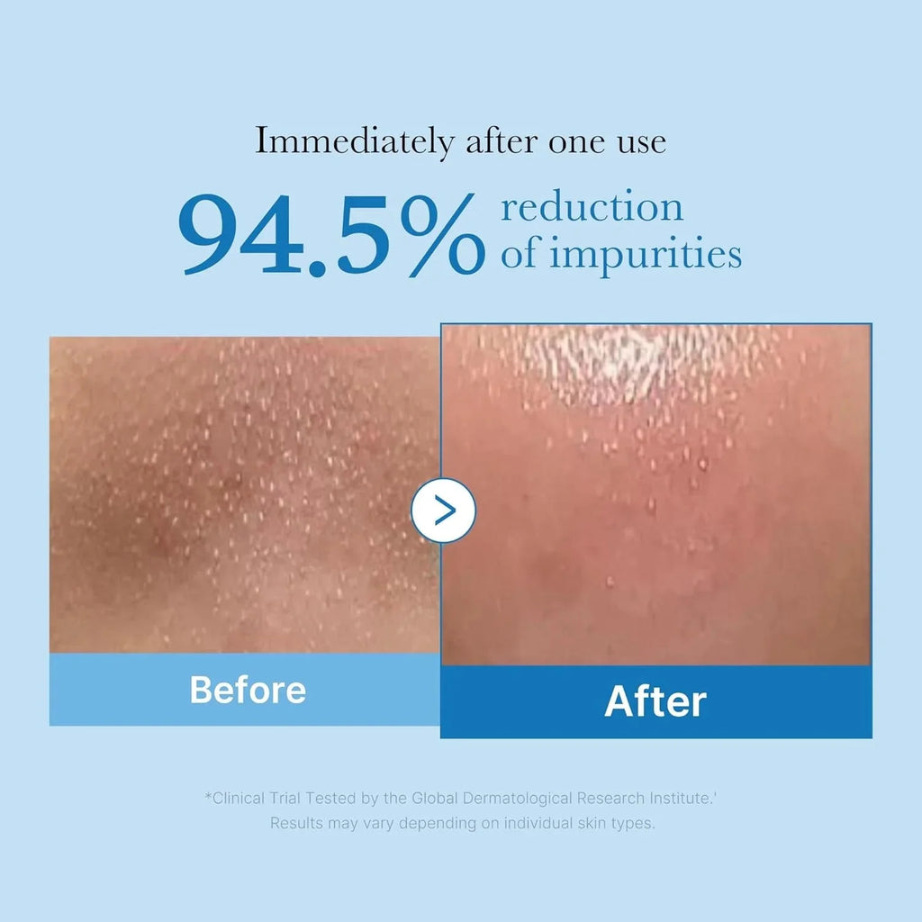 medicube Zero Pore Blackhead Deep Cleansing Oil 205ml