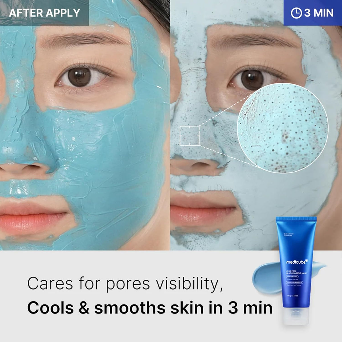 medicube Zero Pore Blackhead Mud Mask 100g