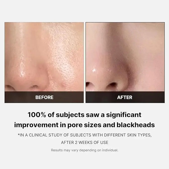 medicube Zero Pore Pad 70 pads