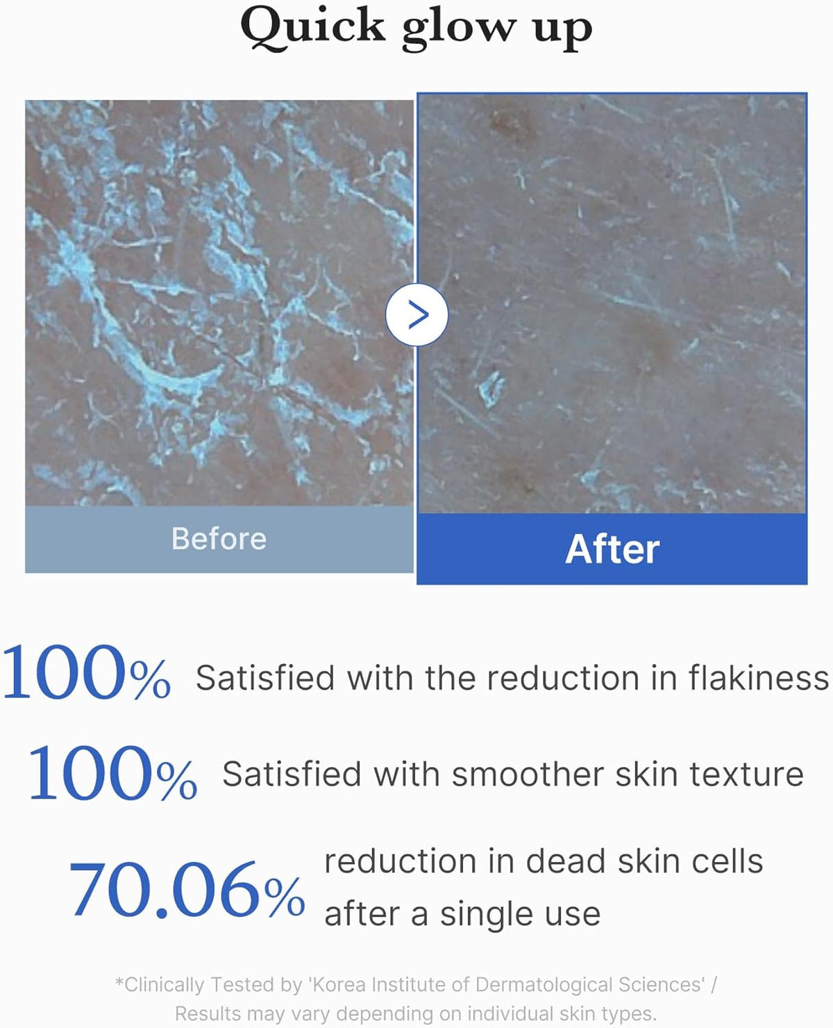 medicube  Zero Pore Peel Pad 8ea