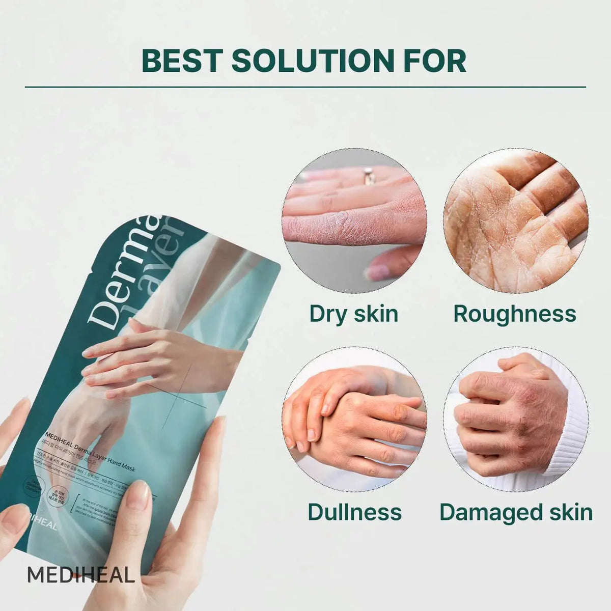 MEDIHEAL Derma Layer Hand Mask (5 Pack)