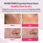MEDIHEAL Rose PDRN Essential Mask 10pcs