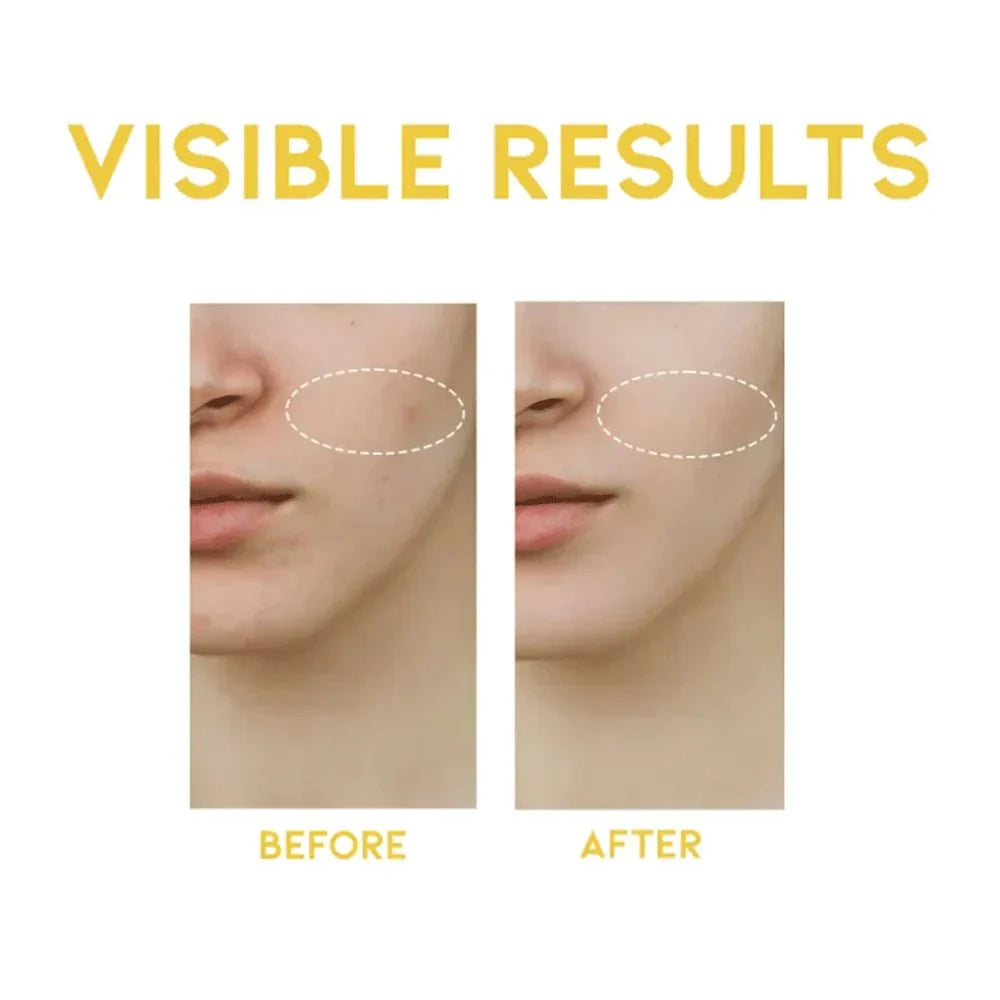 OOTD Dark Spot Vitamin C Serum 50ml
