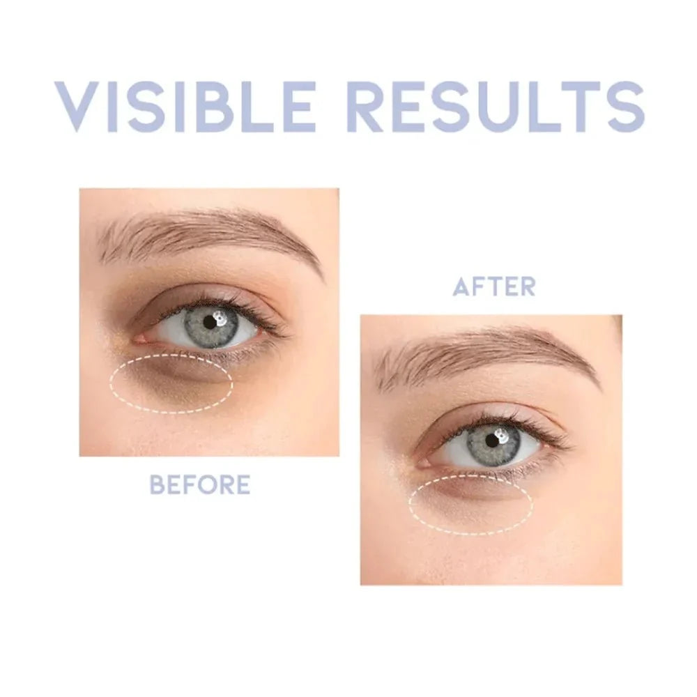 OOTD Intensive Eye Serum 30g