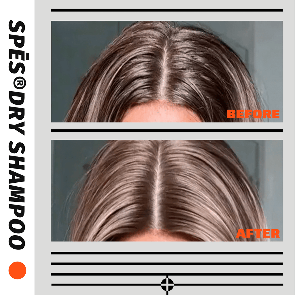 Spēs Dry Shampoo 150ml (3 Styles)
