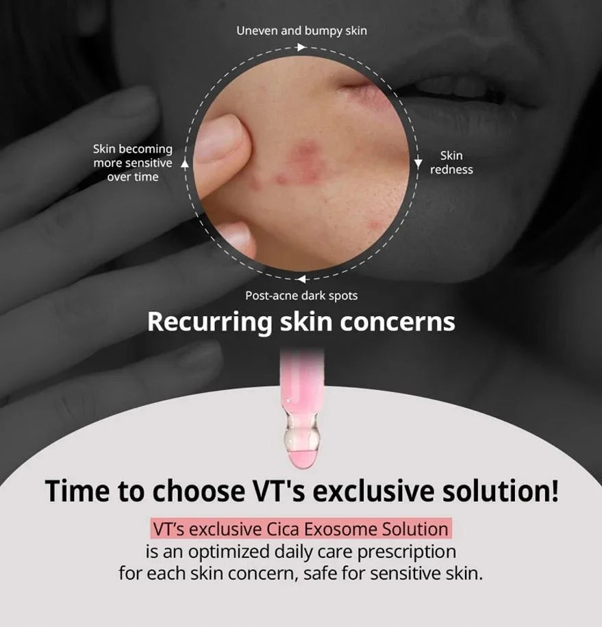 VT Azelaic A1 Calming Ampoule 30ml